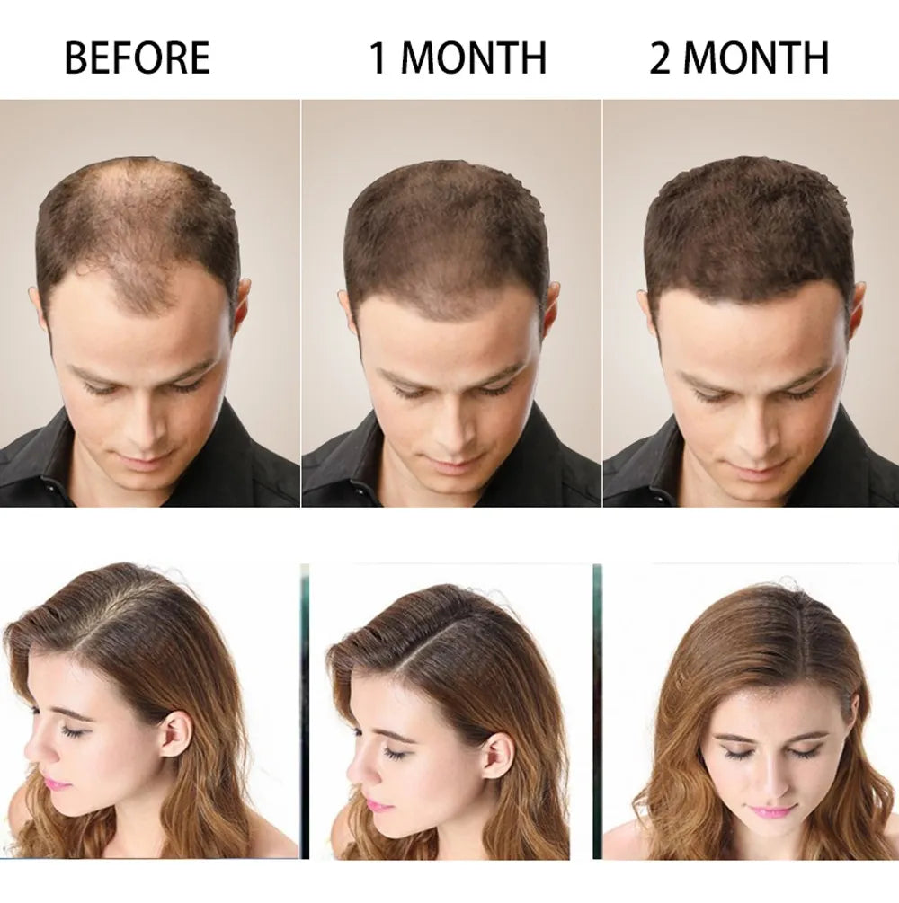 Shampoo Anticaida Hair